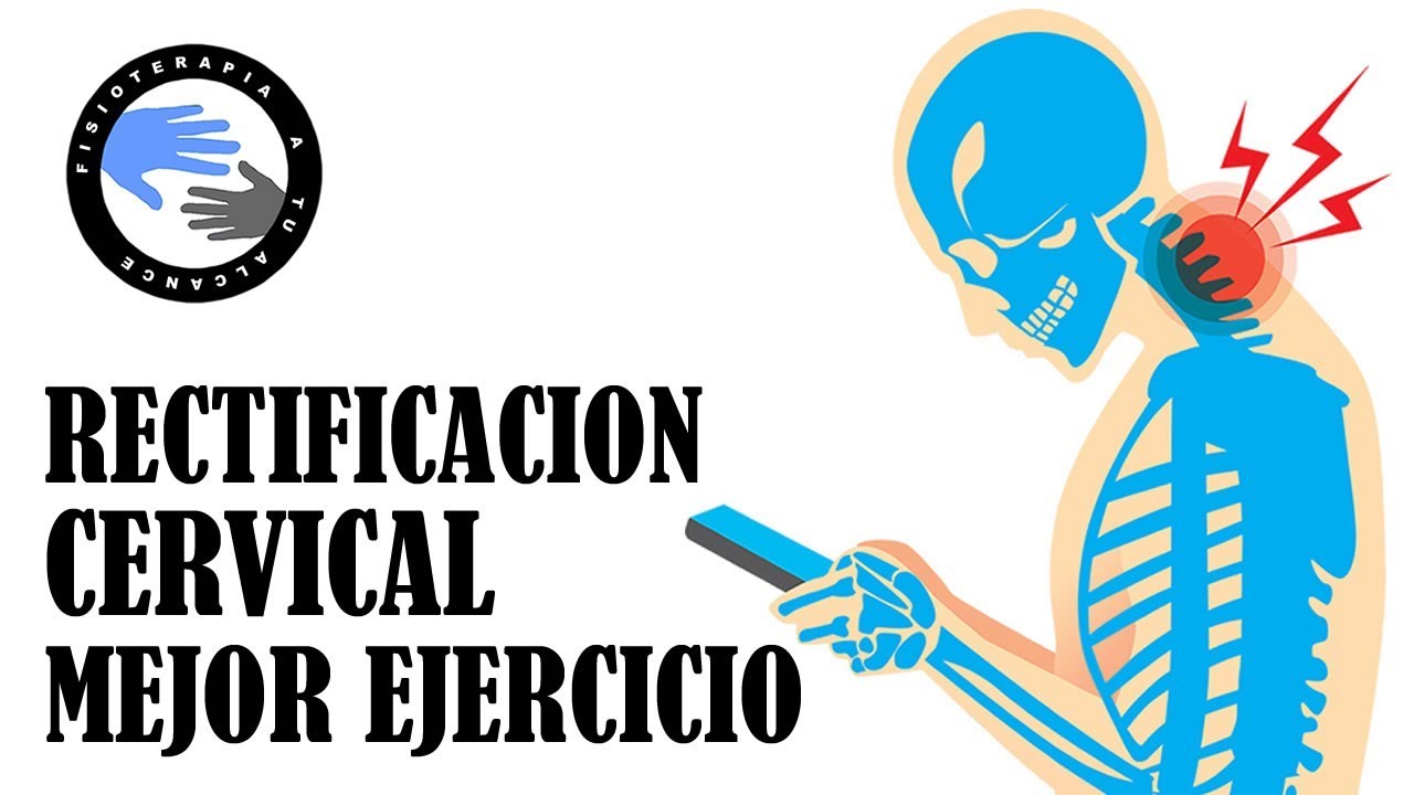 Elimina el dolor con estos ejercicios para lordosis cervical