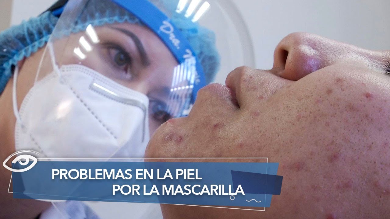 ¿Sufres alergia a la mascarilla? Aquí te explicamos los síntomas