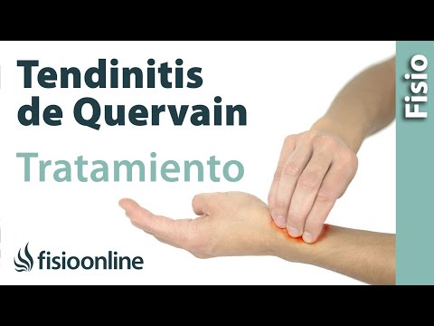 Descubre cuántas sesiones de fisioterapia necesitas para curar una tendinitis