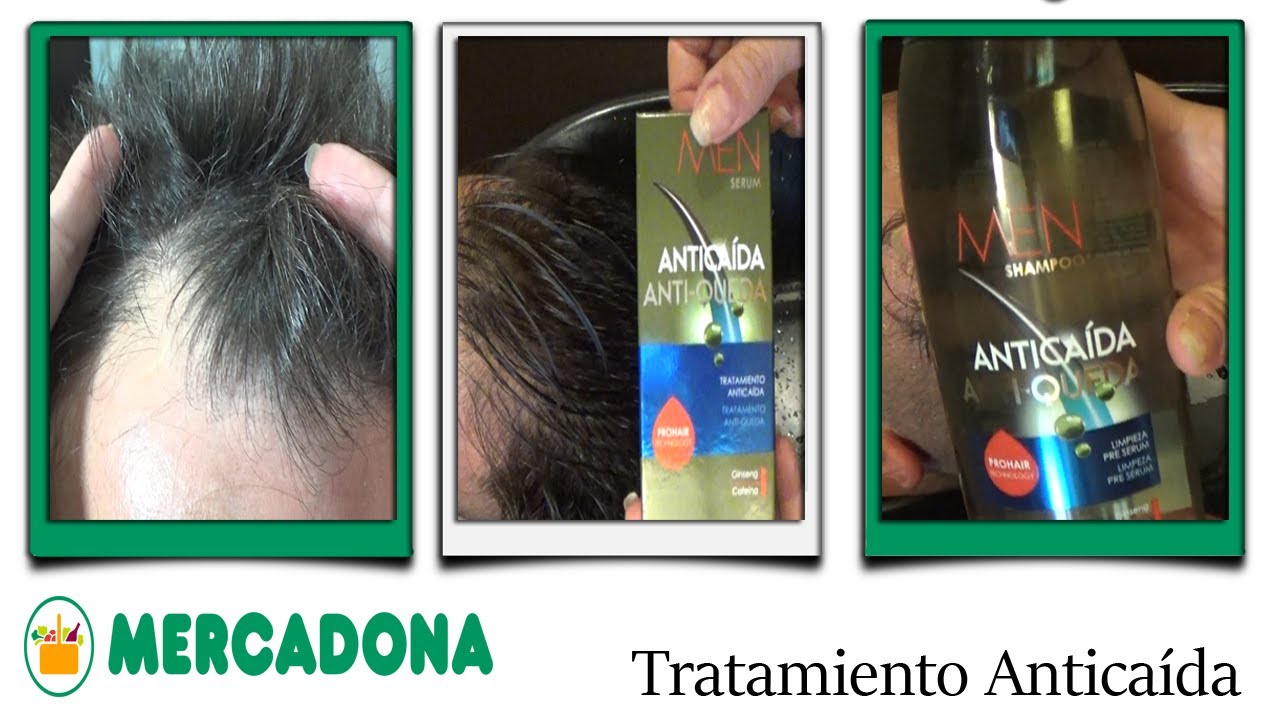 Descubre el revolucionario shampoo con minoxidil de Mercadona para el crecimiento capilar