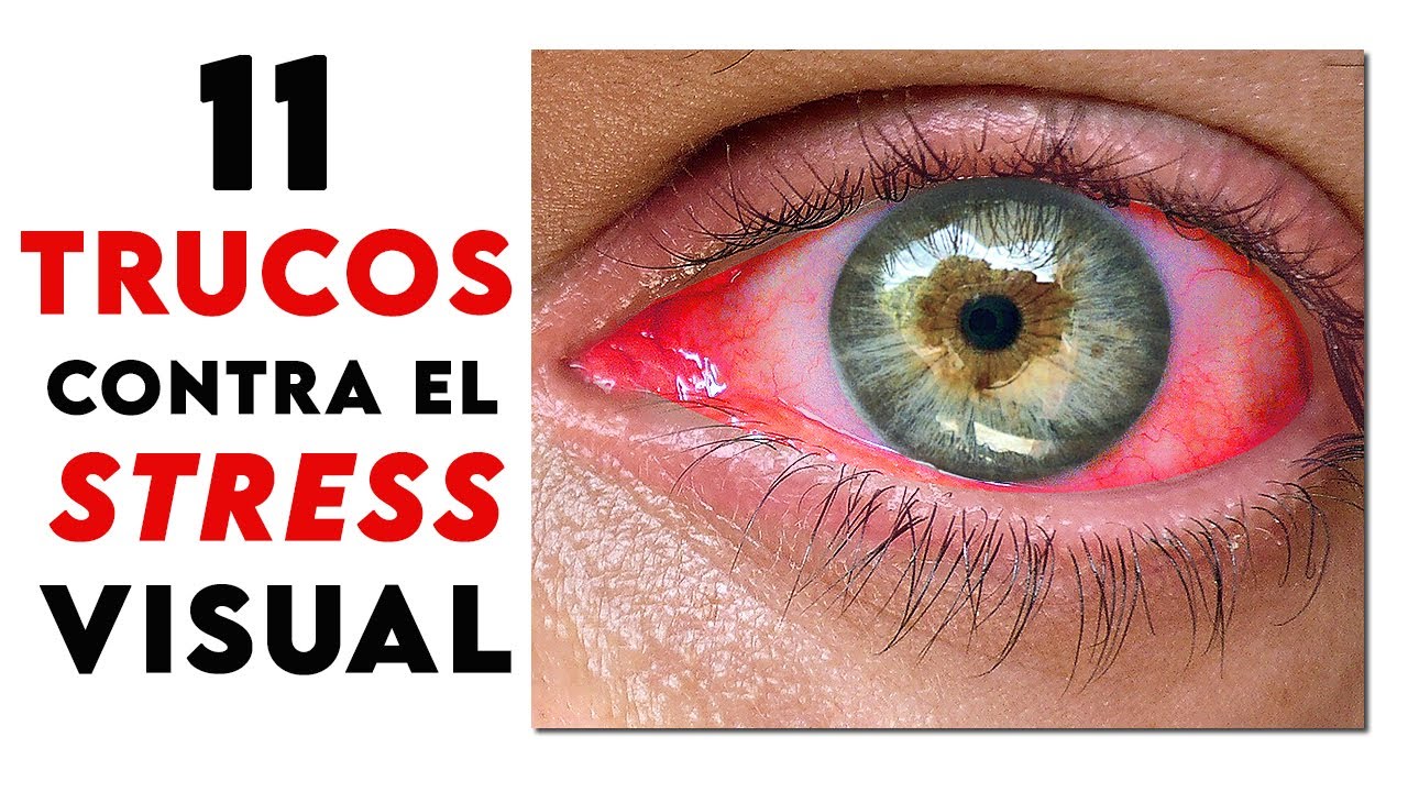Punto negro en el ojo: ¿sabías que puede ser causado por estrés?