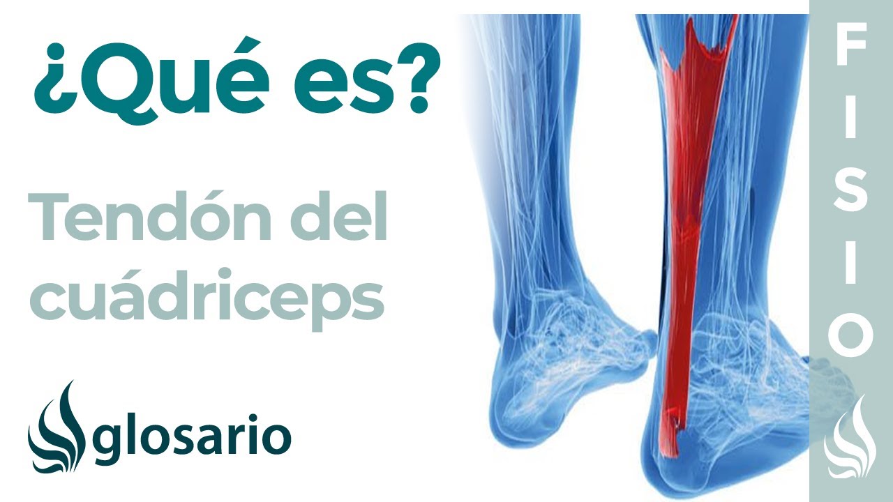 ¡Atención corredores! Cómo tratar la inflamación del tendón de cuádriceps en 5 pasos