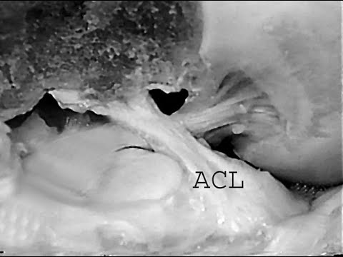 Descubre la sorprendente anatomía del LCA en solo 70 caracteres