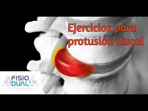 Ejercicios efectivos para aliviar la protusión discal L5S1