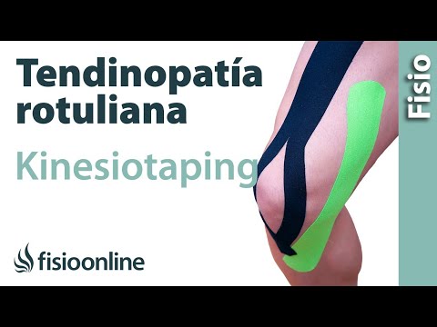 Alivia el dolor: Vendaje Funcional para Tendinitis Rotuliana en Rodillas