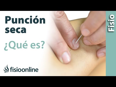 Aprende sobre la punsión seca para aliviar tus dolores